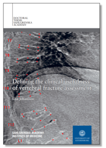 Omslag avhandling Defining the clinical usefulness of vertebral fracture assessment